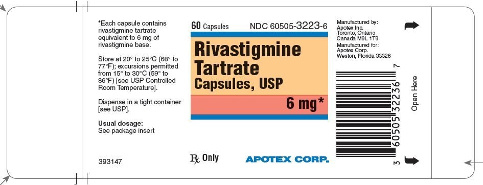 Rivastigmine Side Effects