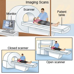 open pet scan machine