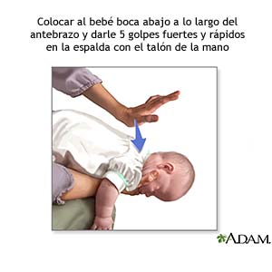 Realización De La Maniobra Heimlich Care Guide Information En Espanol