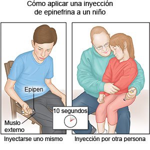 Aplicar una inyección de epinefrina a un niño
