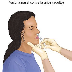 Vacuna nasal contra la gripe (adulto)