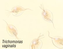 Trichomoniasis Guide Causes Symptoms And Treatment Options