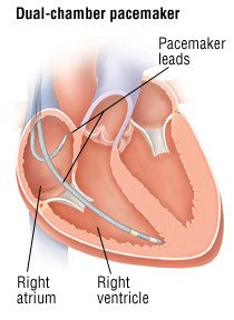 Bradycardia Causes Symptoms Treatment Options Drugs Com