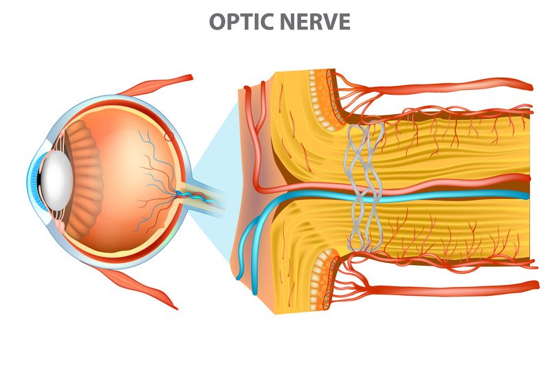 Optic Nerve Swelling papilledema Guide Causes Symptoms And 