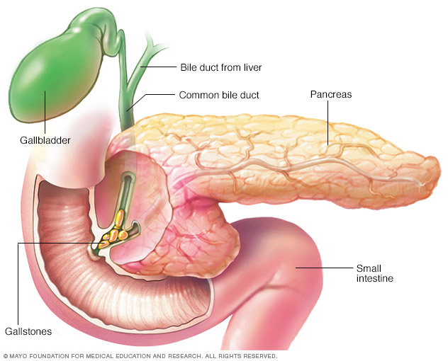Pancreatitis Disease Reference Guide 5510