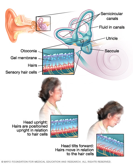 Dizziness Disease Reference Guide Drugs Com