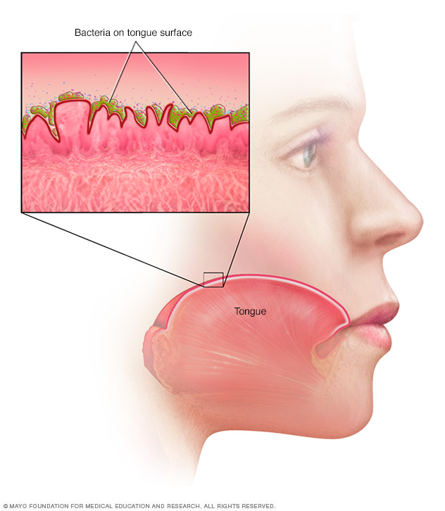 Bad Breath Disease Reference Guide Drugs