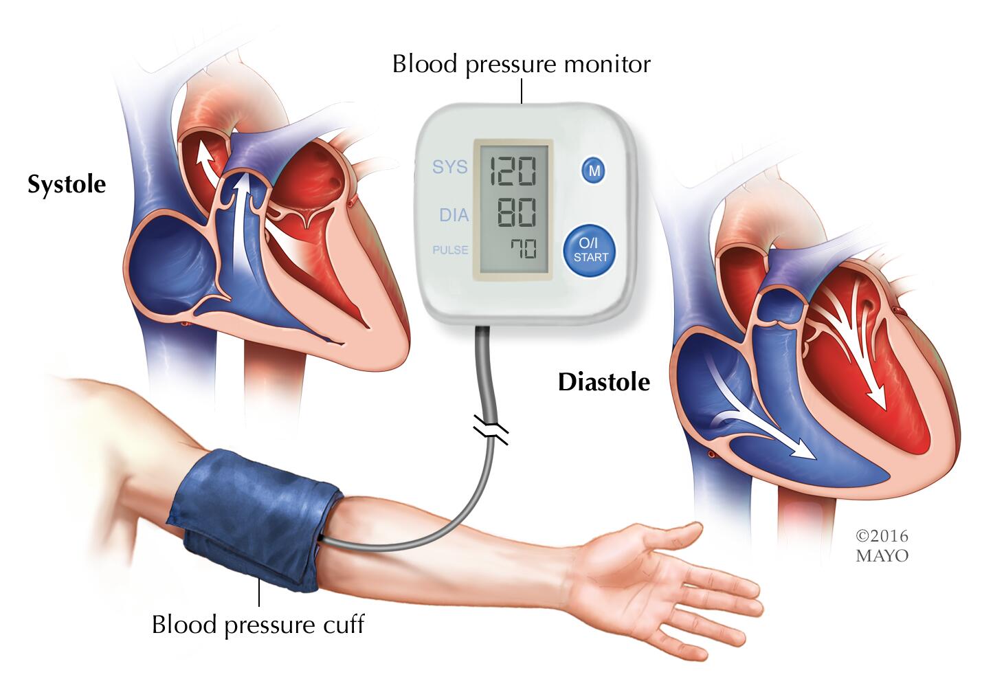 Снижение систолического ад. Ад артериальное давление. Измерение артериального давления. Повышение давления. Повышенное артериальное давление.