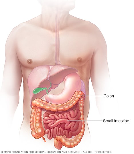 intestinal-obstruction-disease-reference-guide-drugs