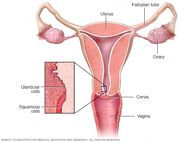 Cervical cancer Disease Reference Guide - Drugs.com epidermoid cyst diagram 