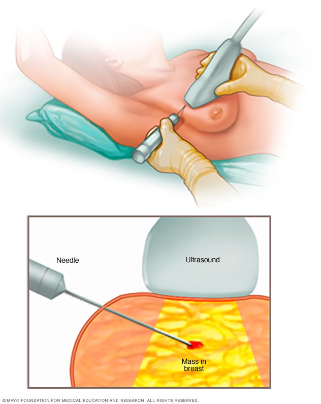 Liver disease - Wikipedia