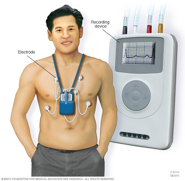 test heart monitor r Drugs.com   monitor Holter