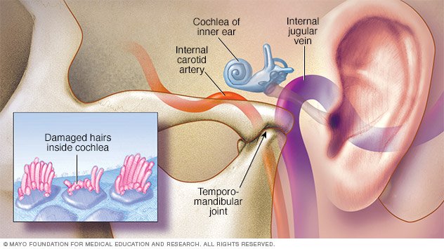 Tinnitus Disease Reference Guide 4477