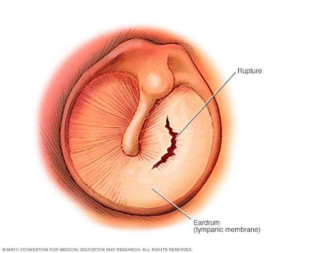 researchers-create-scaffolds-for-eardrum-replacement-minds-of-malady