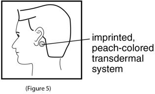 Instructions for Use Figure 5