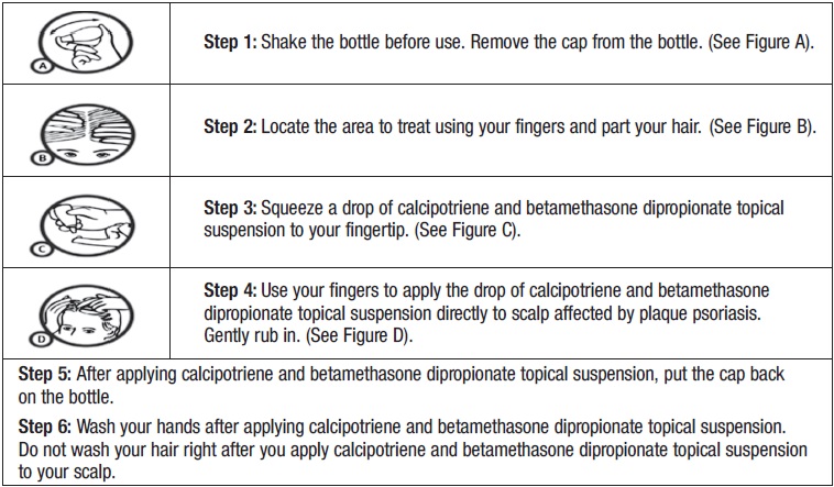 Diagram of Instructions for Use