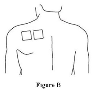 Figure B