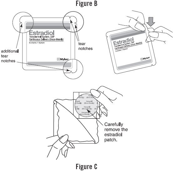 Estradiol Patch FDA Prescribing Information Side Effects And Uses